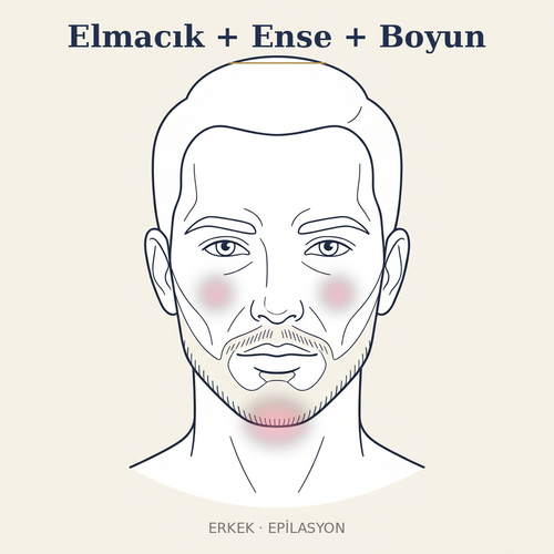 Elmacık + Ense + Boyun Epilasyon