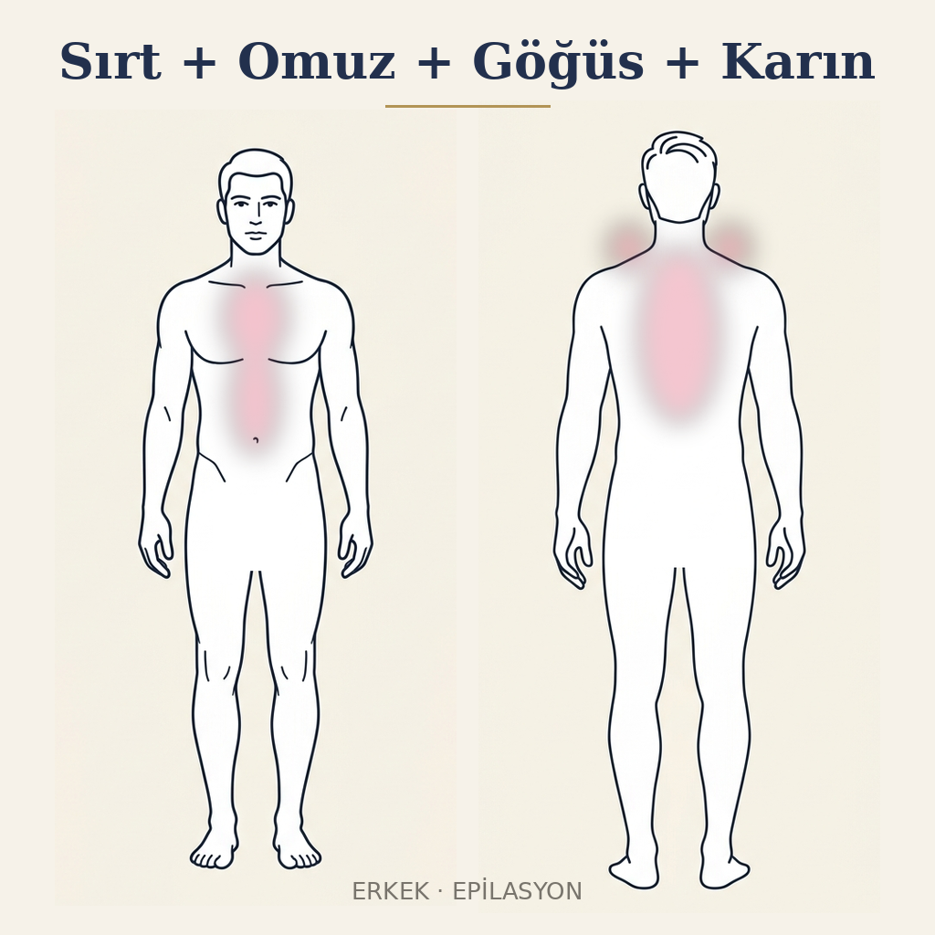 Sırt + Omuz + Göğüs + Karın Epilasyon