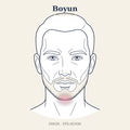 Boyun Epilasyon — Erkek