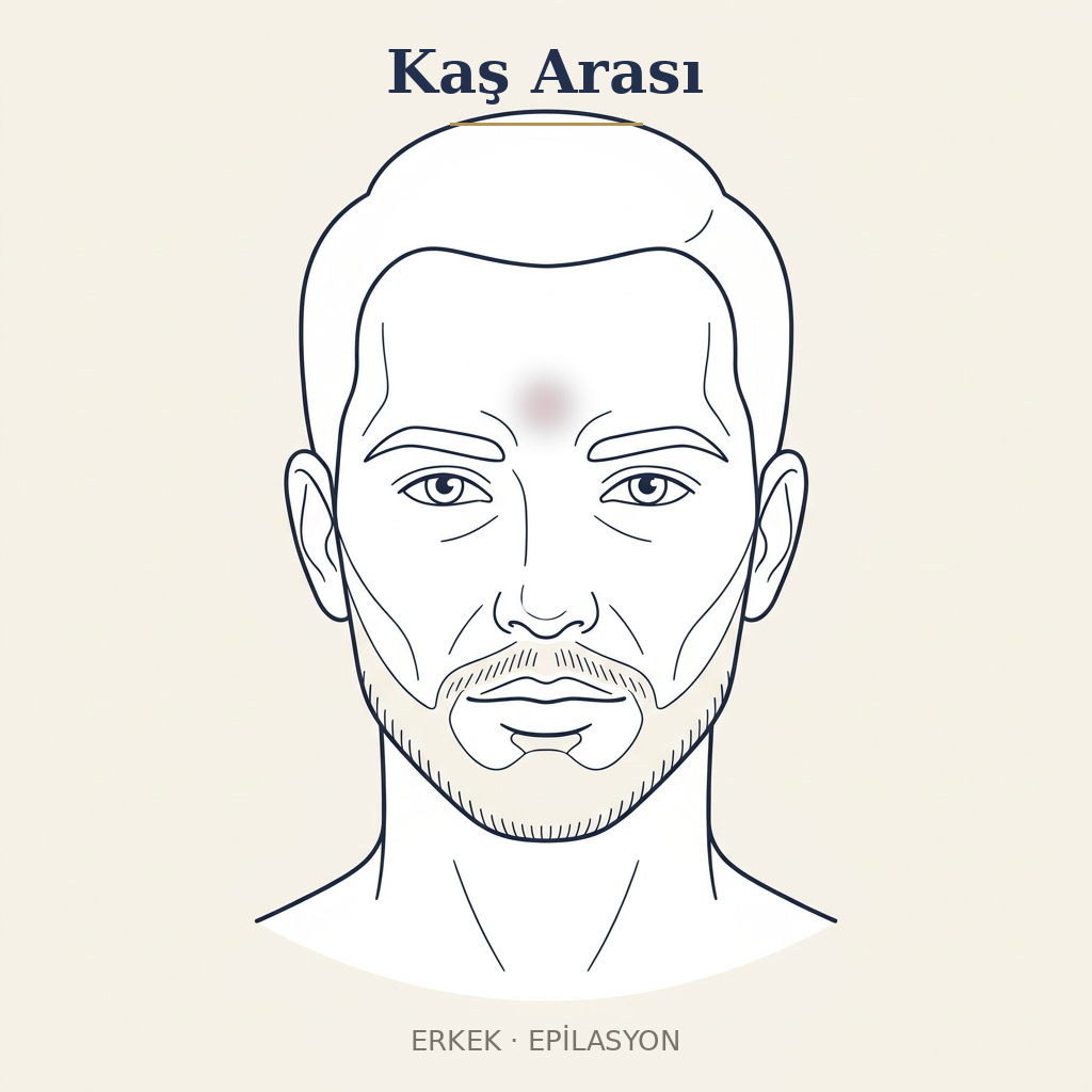 Kaş Arası Epilasyon — Erkek
