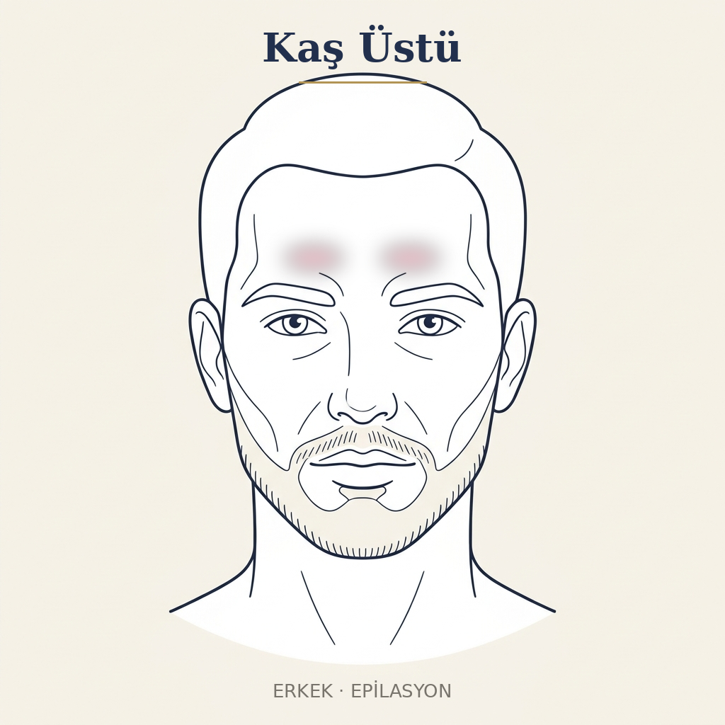 Kaş Üstü Epilasyon — Erkek