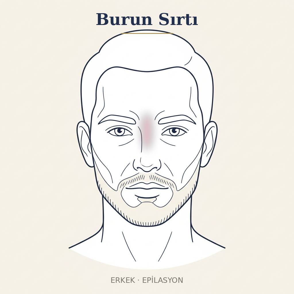 Burun Sırtı Epilasyon — Erkek