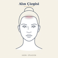 Alın Çizgisi Epilasyon — Kadın