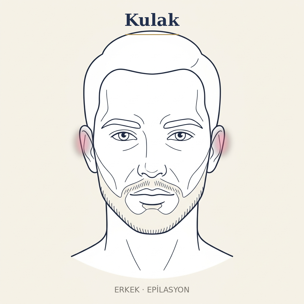 Kulak Epilasyon — Erkek