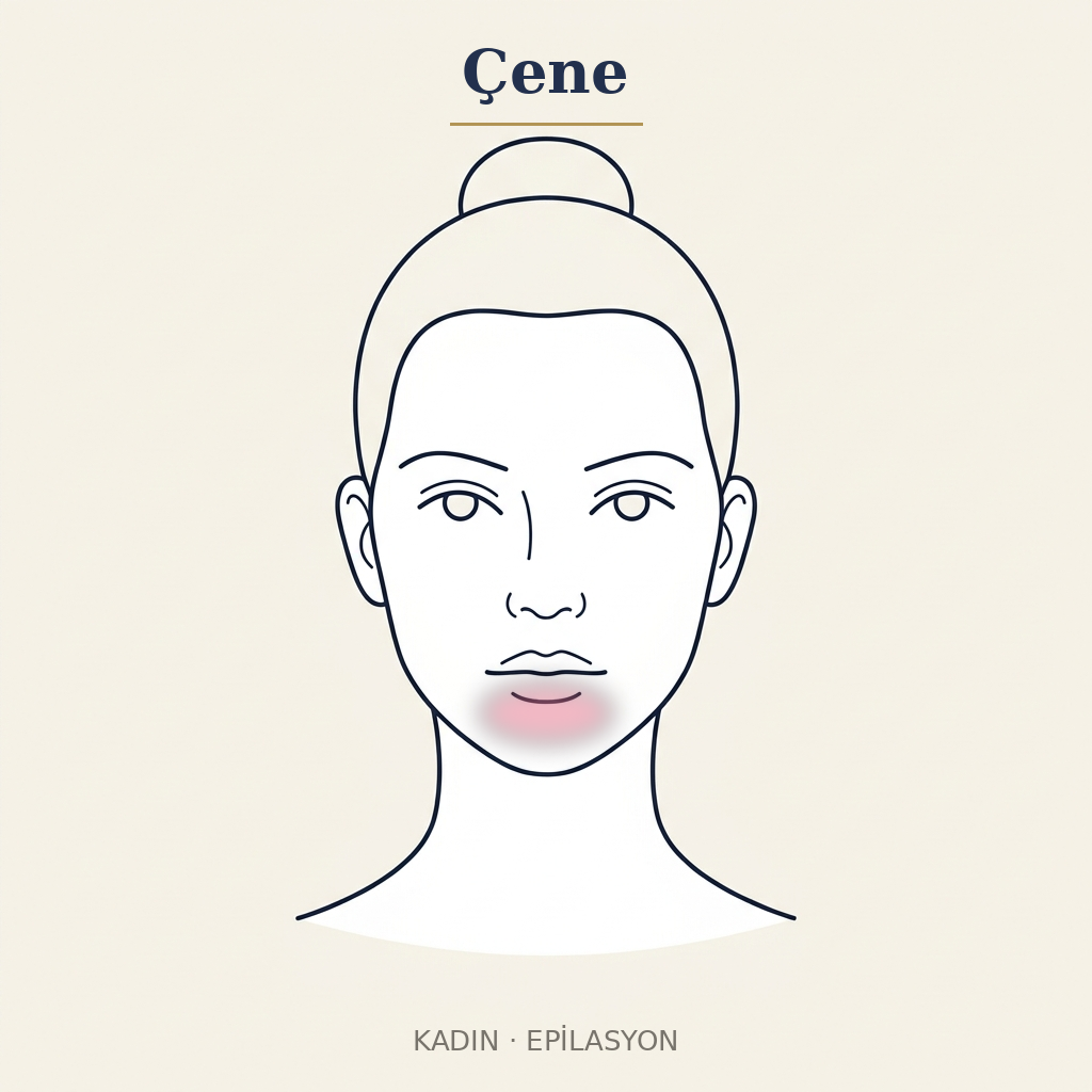 Çene Epilasyon — Kadın